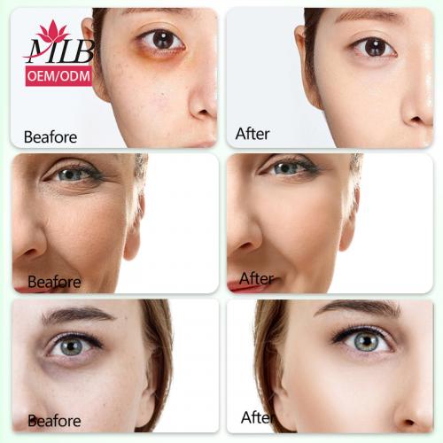 Maschera per gli occhi al collagene di aloe vera Skailie
